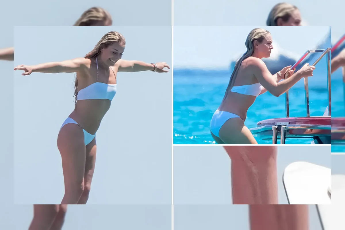 Lindsey Vonn Pamerkan Bekas Operasi di Bikini