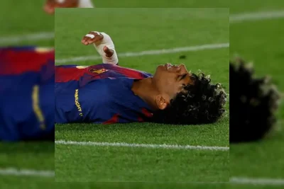 Lamine Yamal Cedera Hamstring, Musimnya Bersama Barcelona Berakhir Lebih Cepat