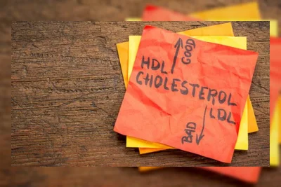 5 Makanan Ini Diam-Diam Bikin Kolesterol Naik Menurut Ahli Gizi