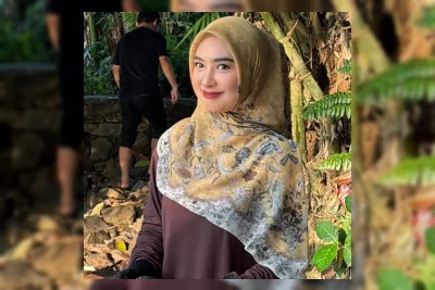 Ria Ricis Jalani Rinoplasti karena Alasan Medis, Bukan Sekadar Estetika