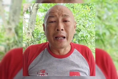 Heru Gundul Alami Pembengkakan Mata 18 Jam Akibat Semburan Bisa Kobra