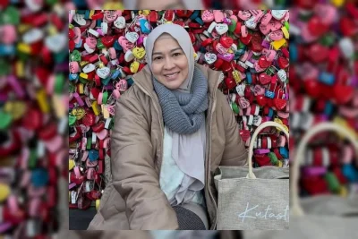 Okie Agustina Bantah Operasi Plastik, Ungkap Prosedur Perbaikan Gagal Filler