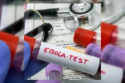 Kasus Ebola di Kongo Melonjak Jadi 452, 82 Orang Meninggal