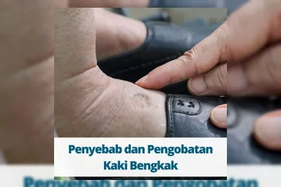 Depresiasi Rupiah Tekan Industri Alas Kaki, Biaya Bahan Baku Melonjak 40%