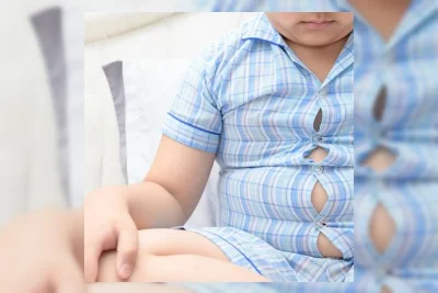 Dokter Anak Ingatkan Orang Tua Tidak Hentikan Konsumsi Susu pada Anak Obesitas