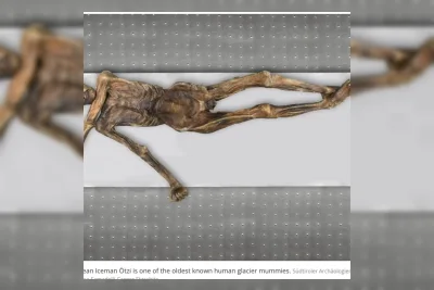 Ilmuwan Temukan Ekosistem Mikroba Purba Hidup di Tubuh Mumi Ötzi