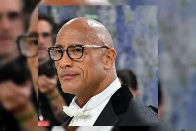 Dwayne Johnson Alami Epididymitis, Bukan Kanker Testis