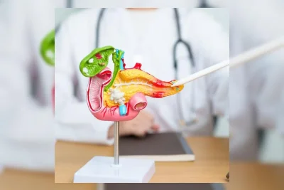 Analisis Feses Bisa Deteksi Dini Kanker Pankreas Lewat Bakteri Usus