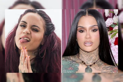 Kehlani: Good Genes atau Good Docs? Transformasi Penampilan Sang Penyanyi