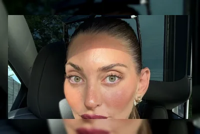 Influencer yang Jalani Operasi Jantung Saat Hamil Buka Suara soal Kehilangan Bayi