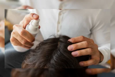 2 Hair Tonic dengan Oleanolic Acid Rekomendasi Dokter untuk Atasi Rambut Rontok
