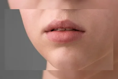 5 Penyebab Bibir Tetap Kering Meski Rajin Pakai Lip Balm