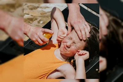 Sunscreen Bikin Kulit Perih? Ini Penjelasan Dokter