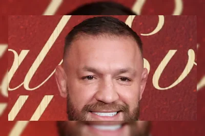 Conor McGregor Kalah dari Max Holloway Usai Cedera Kaki di UFC 329