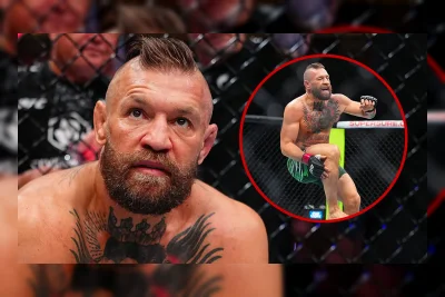 McGregor Jalani Operasi usai Kalah dari Holloway di UFC 329