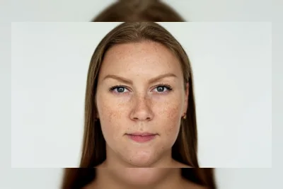 Berapa Lama Flek Hitam Hilang dengan Serum? Ini 6 Rekomendasi Serum Terbaik