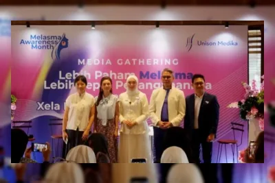 Melasma Bukan Sekadar Flek Biasa, Kenali Penyebab dan Terapi Tepat