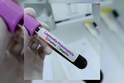 Tiga Orang Meninggal Akibat Wabah Legionnaires di Upper East Side