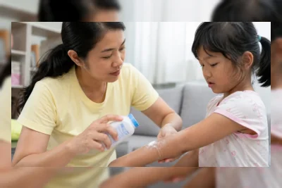 7 Bedak Gatal Paling Ampuh di Apotek yang Aman dan Terdaftar BPOM