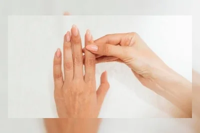 5 Cara Merawat Kuku agar Tidak Mudah Patah, Lindungi dengan Langkah Sederhana Ini