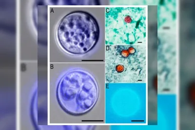 Distrik Sekolah di Kentucky Sesuaikan Menu Akibat Wabah Cyclospora