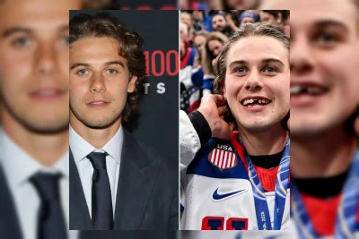 Jack Hughes Ceritakan Cedera Gigi di Olimpiade dan Pemulihannya di TIME100 Gala
