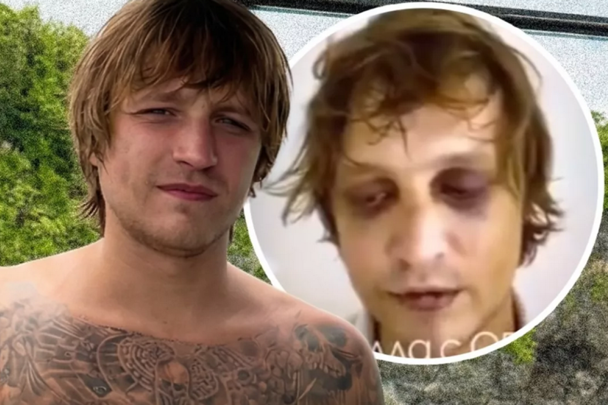 Igor Komarov Hilang di Bali, Polisi Selidiki Dugaan Penculikan dan Video Kekerasan yang Beredar