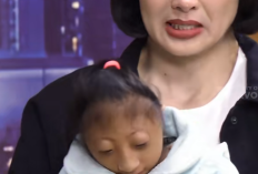 Apa Itu Sindrom Seckel dan Mikrosefali? Penyakit yang Diderita Nabila dan Sabila, Anak Kembar 7 Tahun yang Kini Viral Usai jadi Bintang Tamu di Podcast Sarah Wijayanto