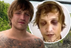 Igor Komarov Hilang di Bali, Polisi Selidiki Dugaan Penculikan dan Video Kekerasan yang Beredar