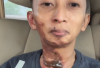 Apa Penyebab Leher DJ Omo Kucrut Terbakar? Benarkah Akibat Aksi Panggungnya saat Nge-DJ?