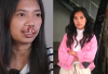 Potret Before After Rista Junianti Sosok Gadis Sumbing Bersuara Merdu yang Diberi Operasi Gratis oleh Dokter Tompi, Makin Cantik dan Menawan